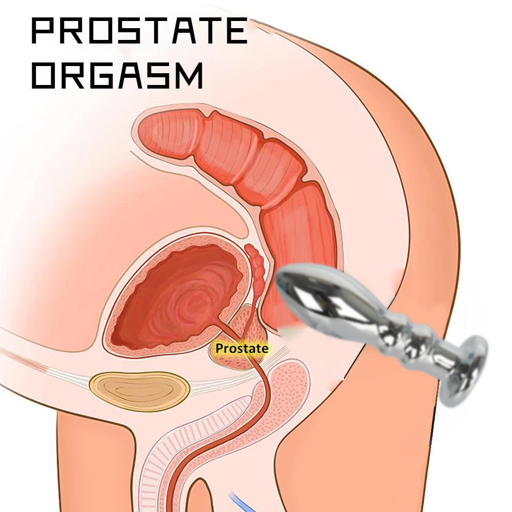 Vibrierender Dildo-Buttplug – Metalldildos G-Punkt-Prostata-Massage-Analspielzeug