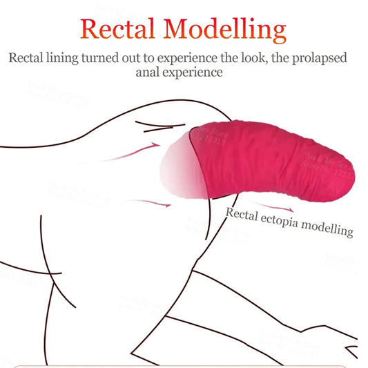 rectal prolapse big anal plug toys