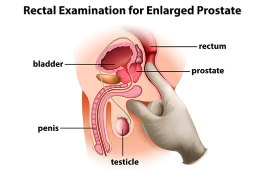 Unexpected Pleasure of Prostate Massager You Need to Try